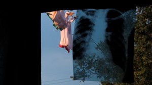 X Ray in Door